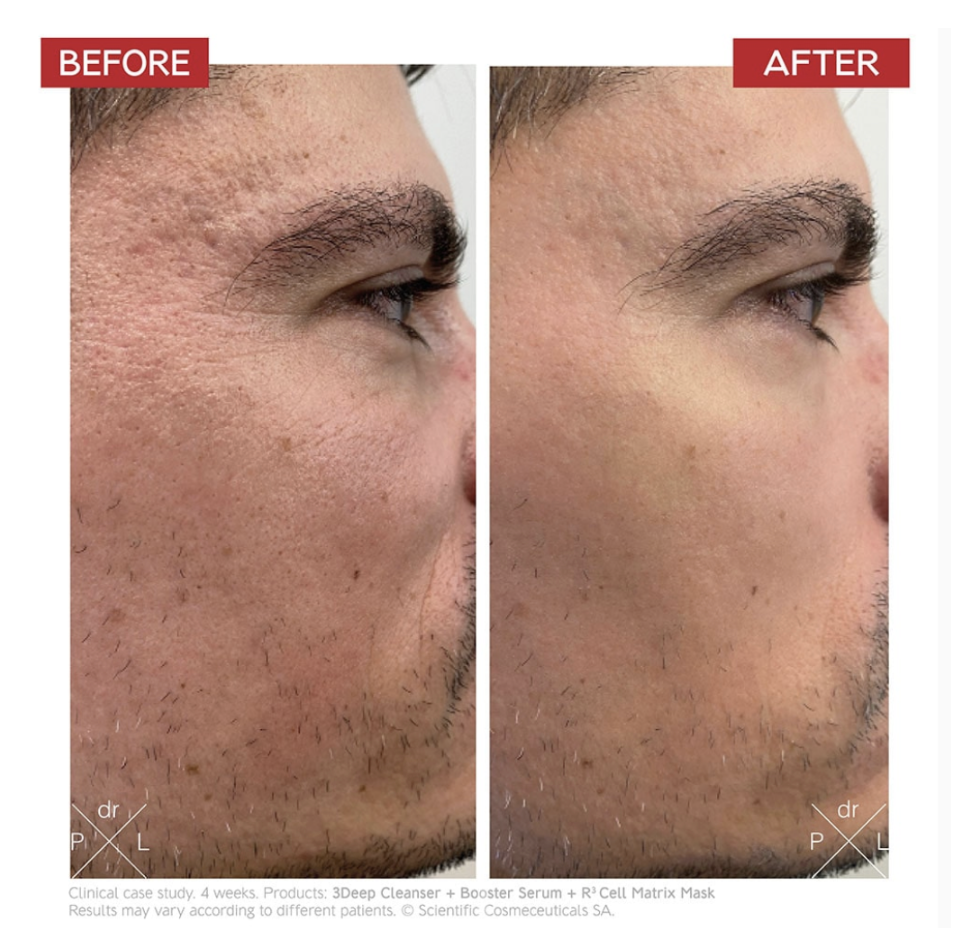BOOSTER SERUM - ANTI-AGING SÉRUM 30 ml