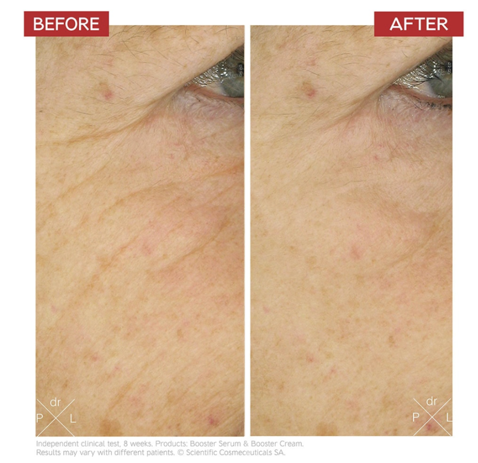 BOOSTER CREAM - VÝŽIVNÝ ANTI-AGING KRÉM 50 ml