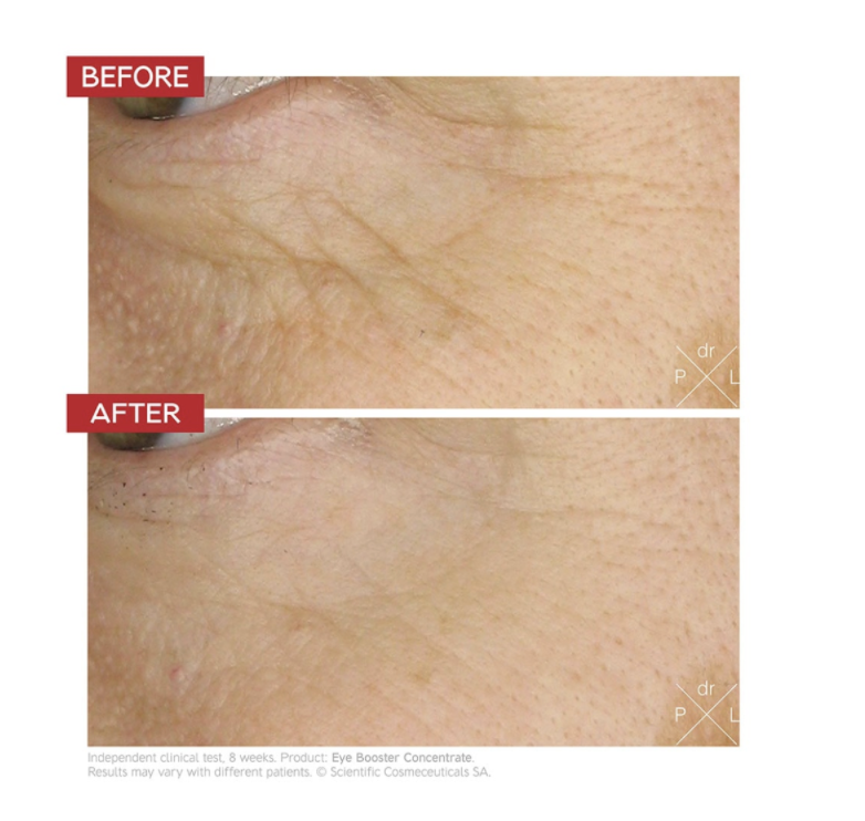 EYE BOOSTER CONCENTRATE - OČNÍ ANTI-AGING BOOSTER 15 ml