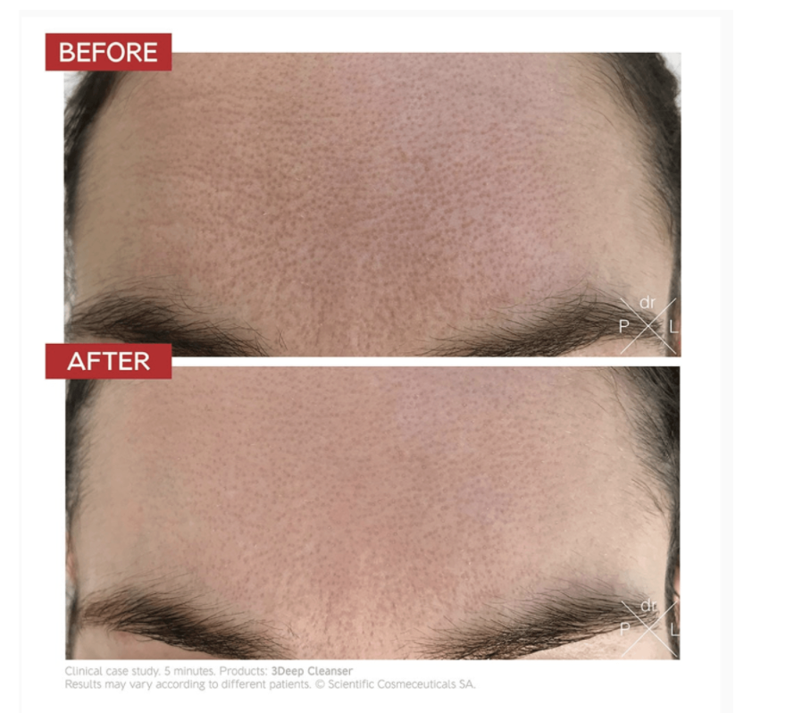 3DEEP CELL RENEWAL MICRO-RESURFACING CLEANSER - ČISTÍCÍ GEL. 150 ml