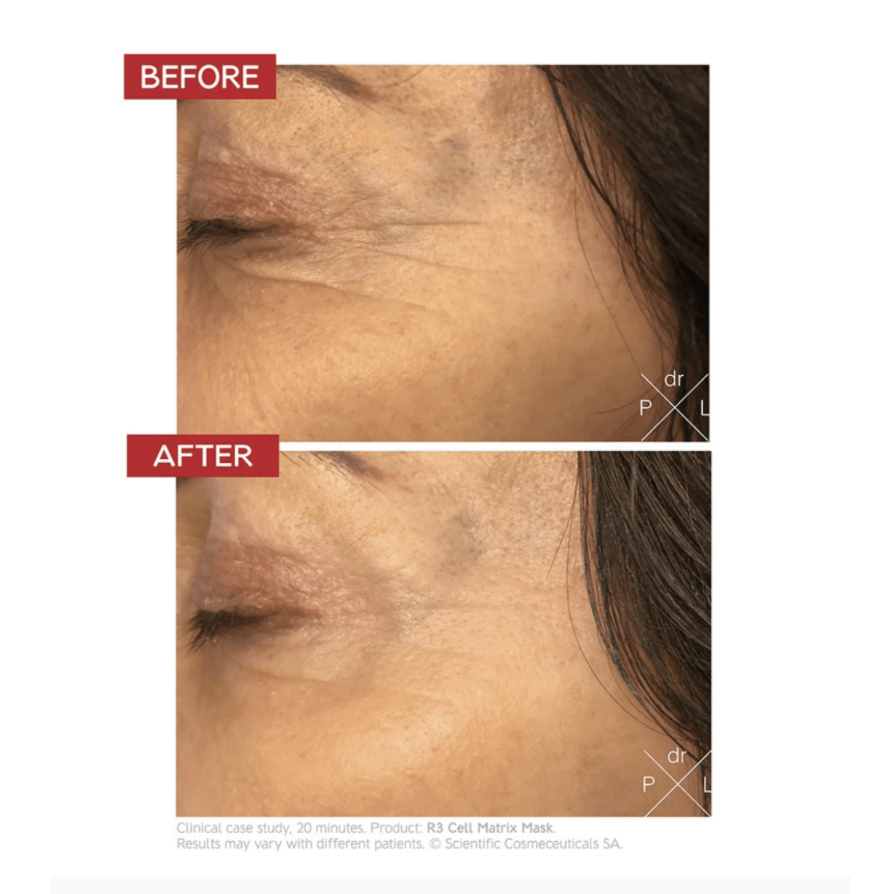 R3 CELL MATRIX MASK - ANTI-AGING VÝŽIVNÁ MASKA 50 ml