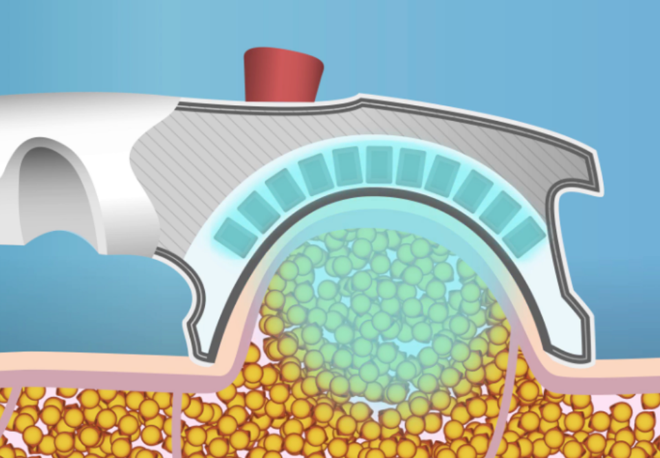 CRYOSLIM HYBRID® pouze na objednávku