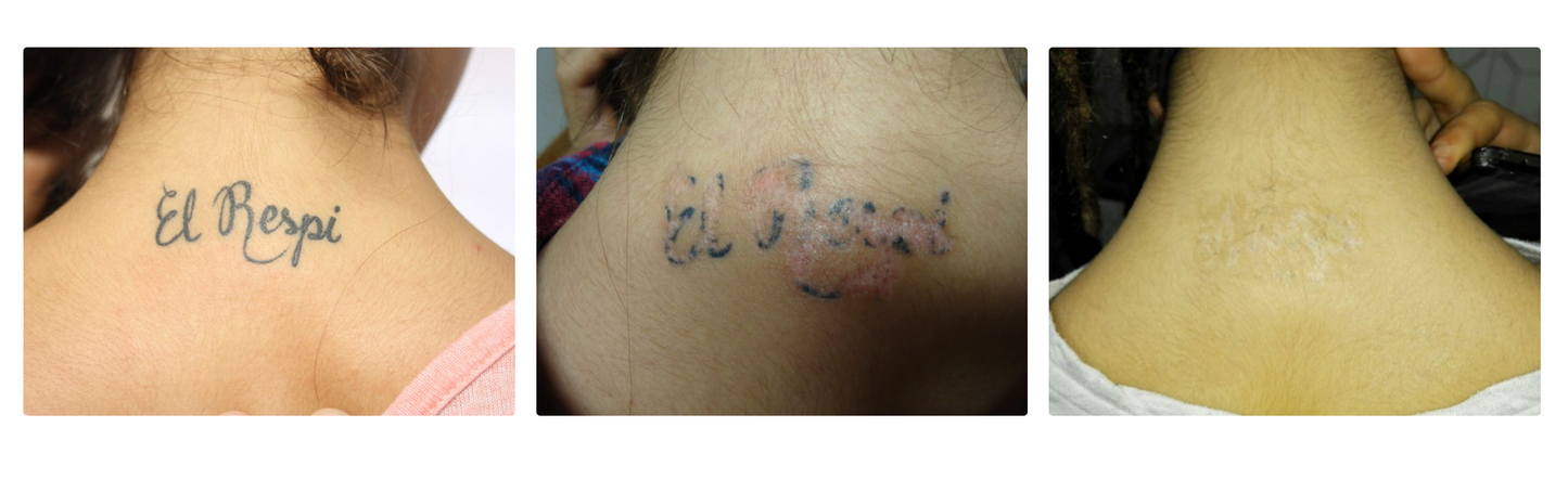 MAGIC-PEN® pouze na objednávku