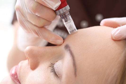 MICRONEEDLING & MEZOTERAPEUTICKÉ KOKTEJLY